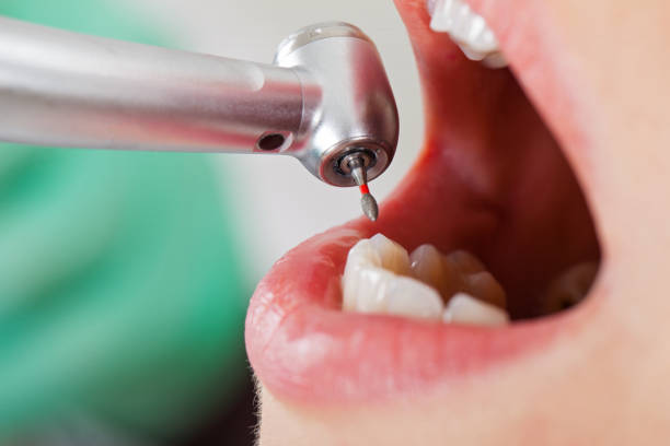 Best Dentist for Tooth Abscess  in Deming, NM